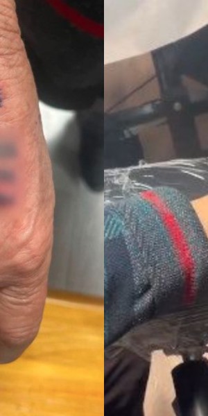 Chinese couple pressures mum with dementia to get hand tattooed with phone numbers, gets flak for being cruel